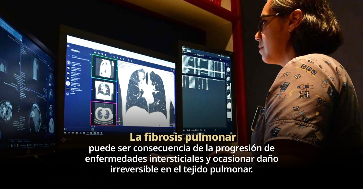 INER llama a identificar oportunamente tos seca y falta de aire, principales síntomas de fibrosis pulmonar